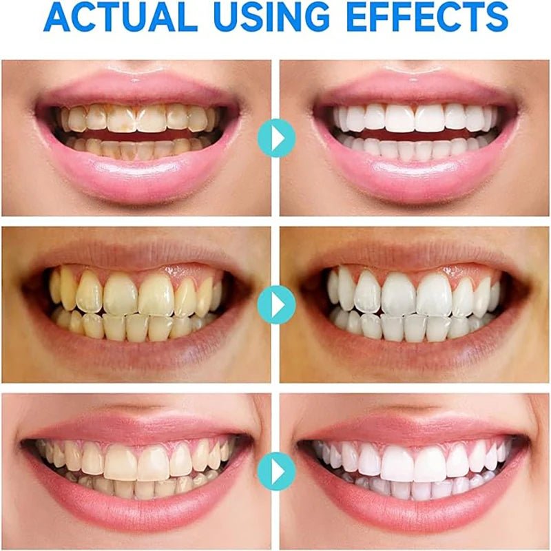 Whitening Tandpasta | Frisse Adem & Gezond Tandvlees | Natuurlijk Wittere Tanden