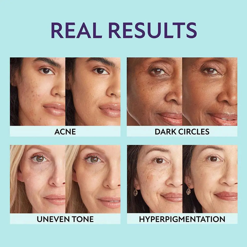 LuxeHoes™ Duurzaam Elegant Ontwerp