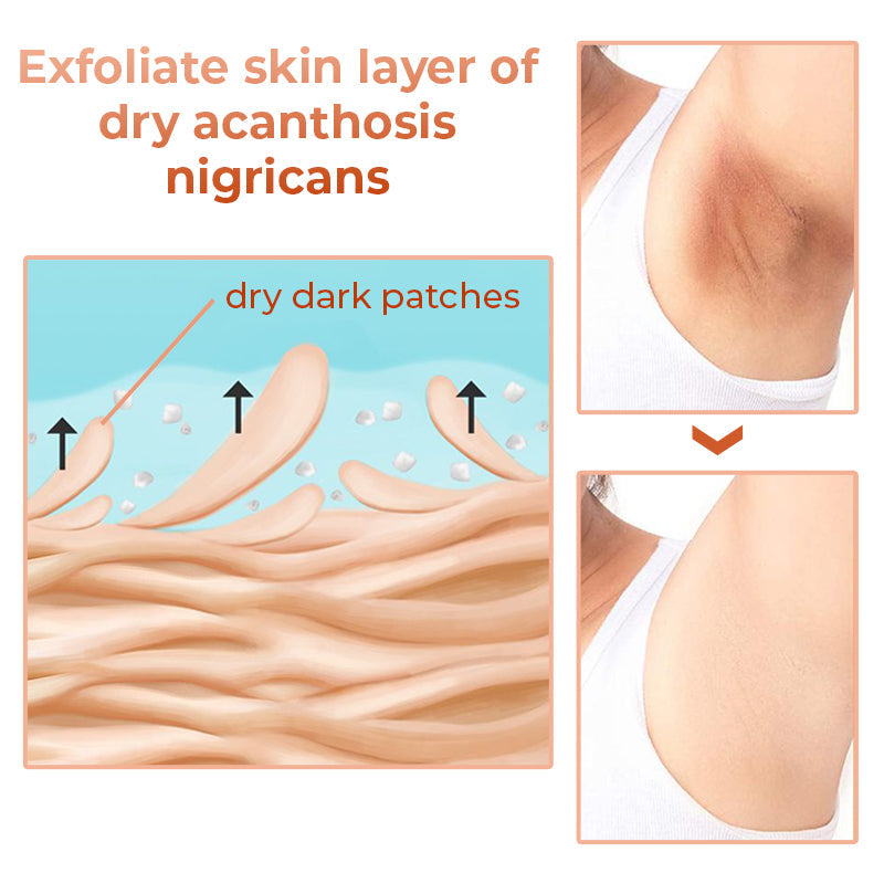 GladdeHuid™ Acanthosis Nigricans Therapieolie