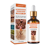 GladdeHuid™ Acanthosis Nigricans Therapieolie