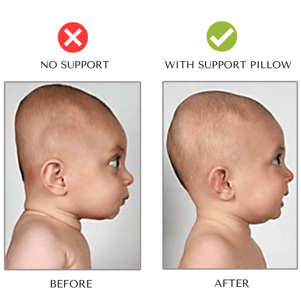 BabyNest™ Gezonde Neupport