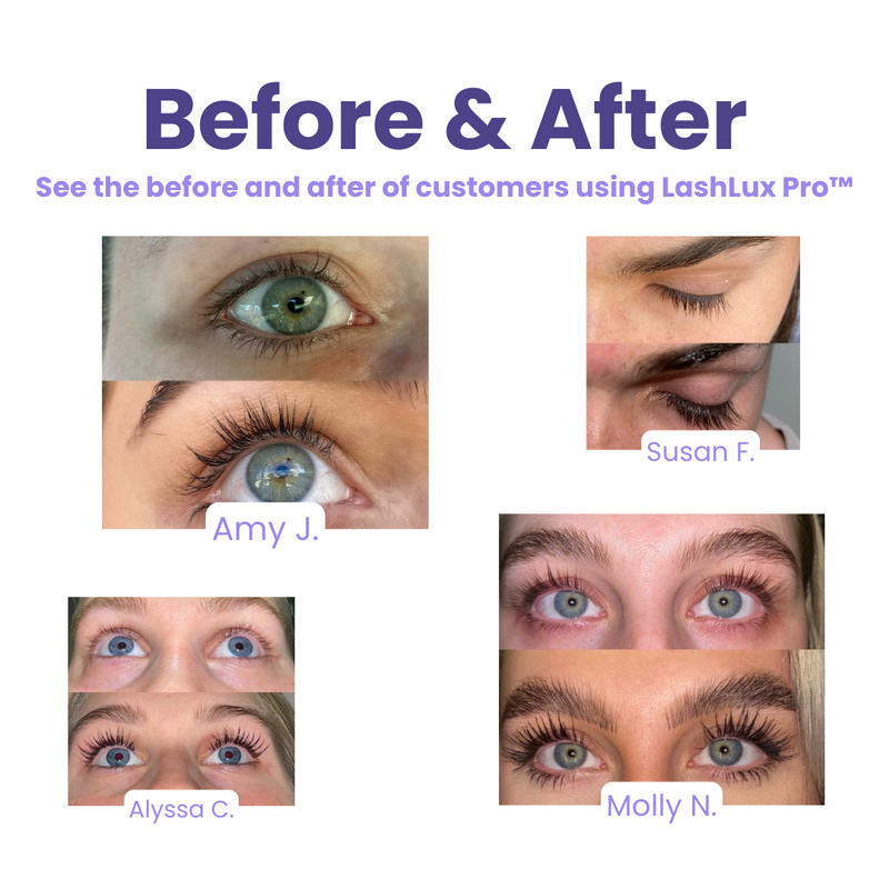 LashBoost™ Wimpergroeiserum (1+1 GRATIS)