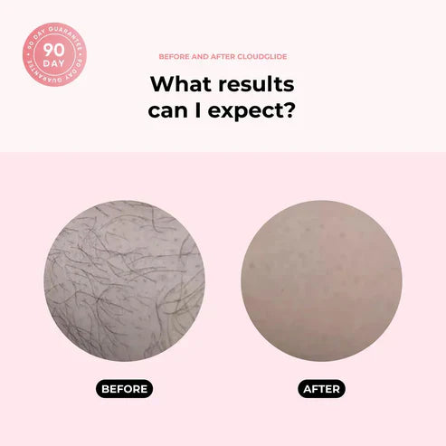 ZachtScheren | Elektrische Ladyshaver | Voor Een Zijdegladde & Irritatievrije Scheerbeurt