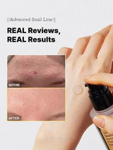 Gezichtsserum met Slakkenslijmextract | Hydratatie & Celvernieuwing | Anti-Aging