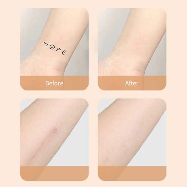 BedekHuid™ Naadloze Imperfectiekapotting