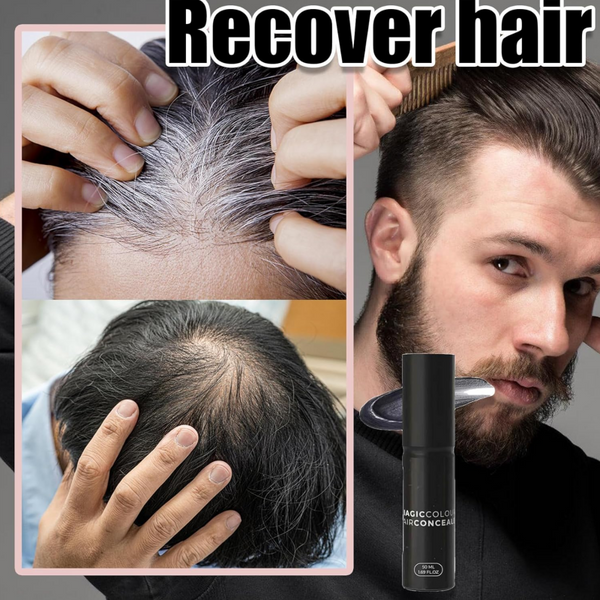 Haarvezel Spray | ScalpWonder™ | Directe Haarbedekking voor Dunner Wordend Haar