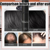 Haarvezel Spray | ScalpWonder™ | Directe Haarbedekking voor Dunner Wordend Haar